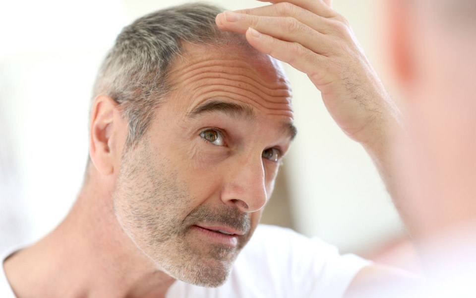 νέα-θεραπεία-για-τη-φαλάκρα-υπόσχεται-2249286