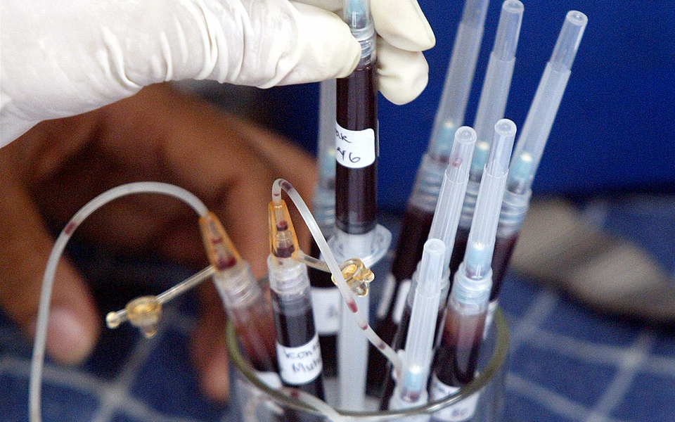 πρόγνωση-καρκίνου-με-εξέταση-αίματος-2253754