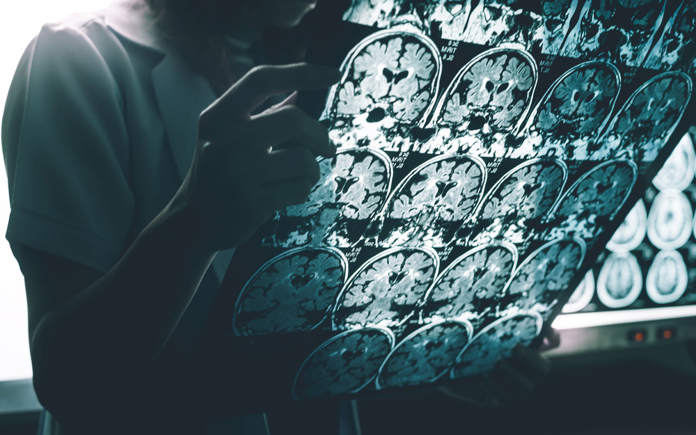 nέες-ελπίδες-για-το-αλτσχάιμερ-από-τη-με-2273677