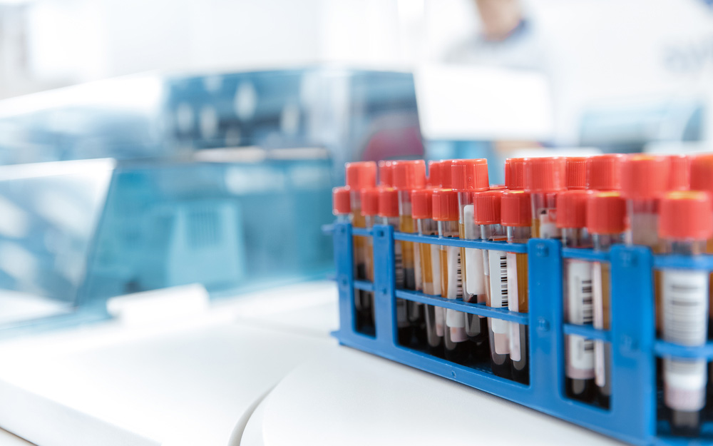 αρχαίος-ιός-συμβάλλει-στον-εθισμό-στα-2274506