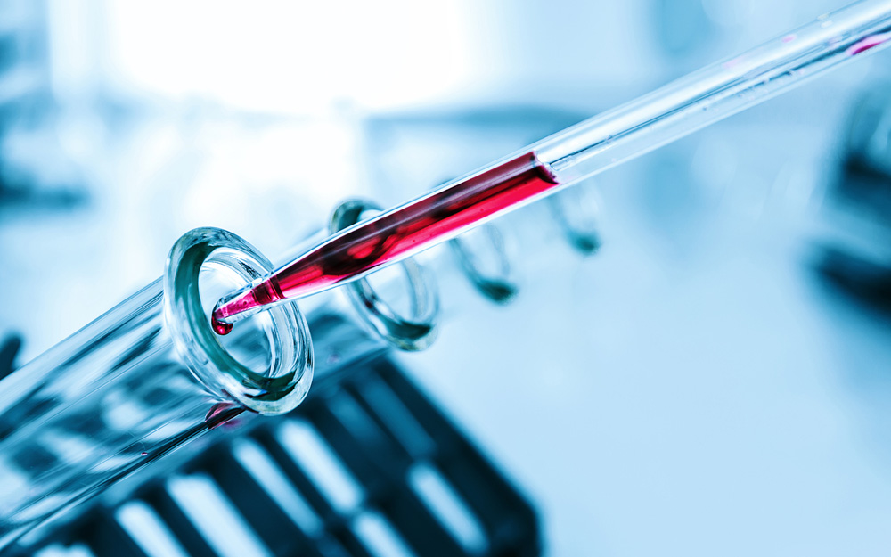 βρετανία-τεστ-αίματος-ανιχνεύει-τον-κ-2272042