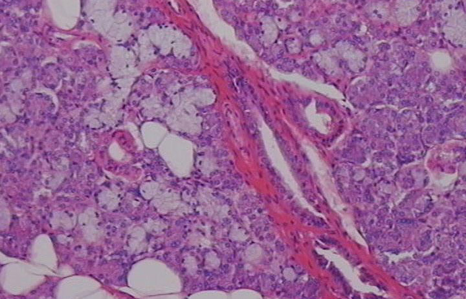 μίνι-σιελογόνο-αδένα-δημιούργησαν-στ-2277668