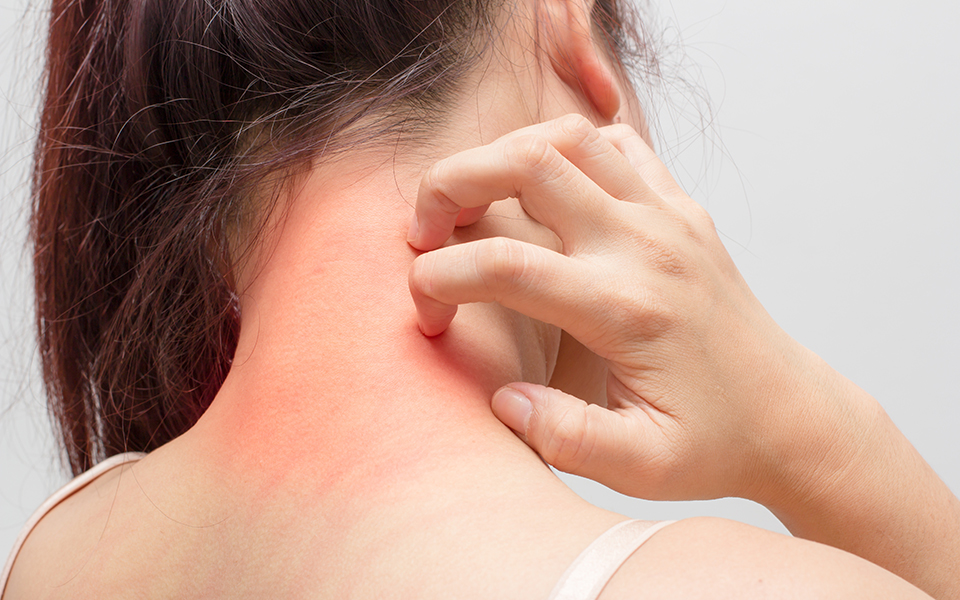 ενας-στους-δέκα-θα-εμφανίσει-έκζεμα-2287964