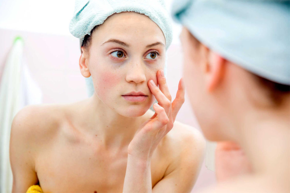 πώς-να-εξαφανίσετε-τους-μαύρους-κύκλο-2291847