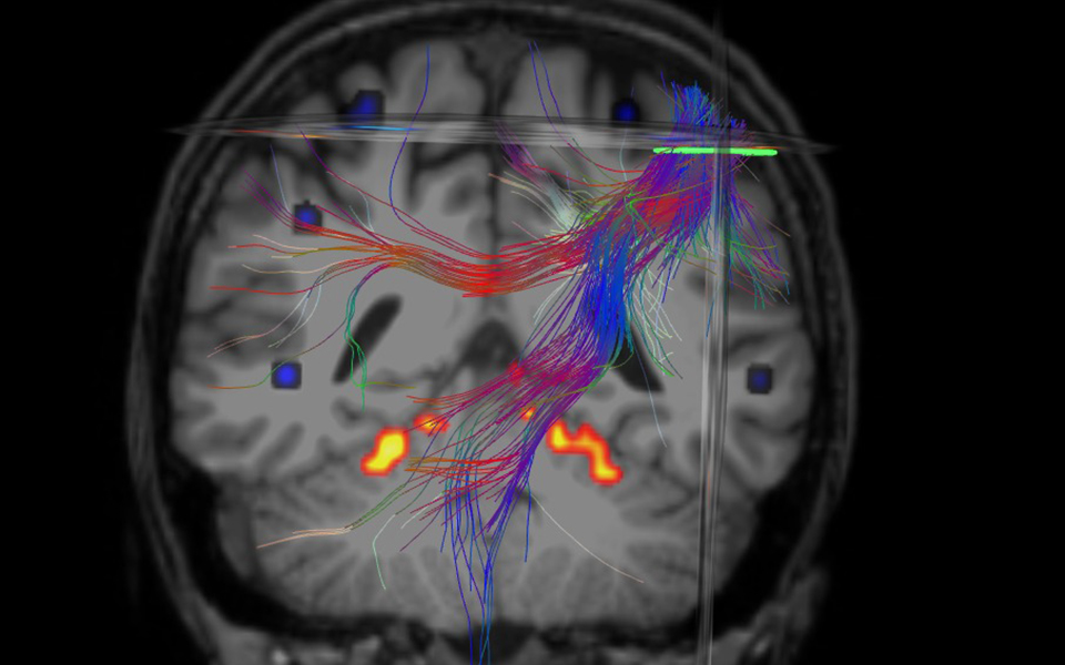 η-startup-που-χαρτογραφεί-τον-ανθρώπινο-εγκέ-2313429