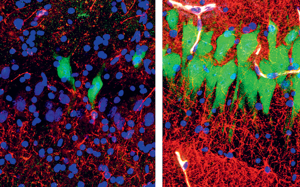 σημάδια-ζωής-σε-εγκεφάλους-νεκρών-χοί-2311954