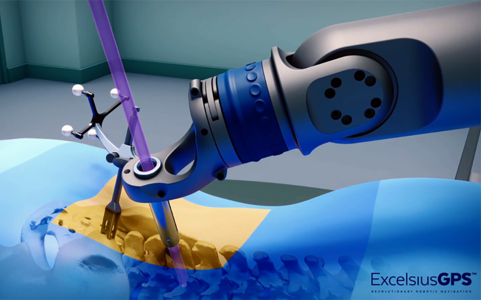 ρομποτική-χειρουργική-σπονδυλικής-σ-2343418