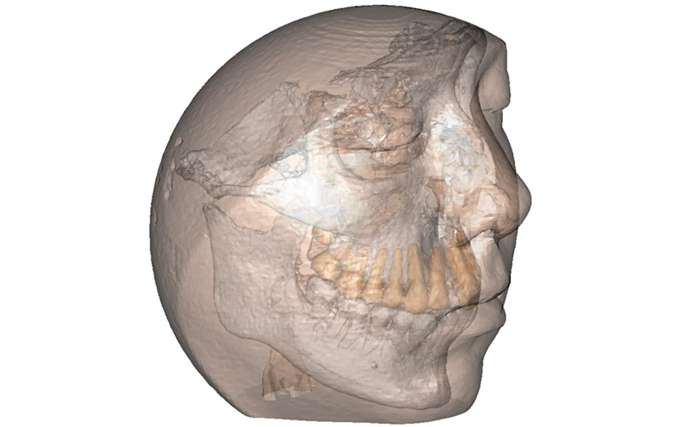 η-ζωή-είναι-3d-τώρα-είναι-και-η-χειρουργι-2343797