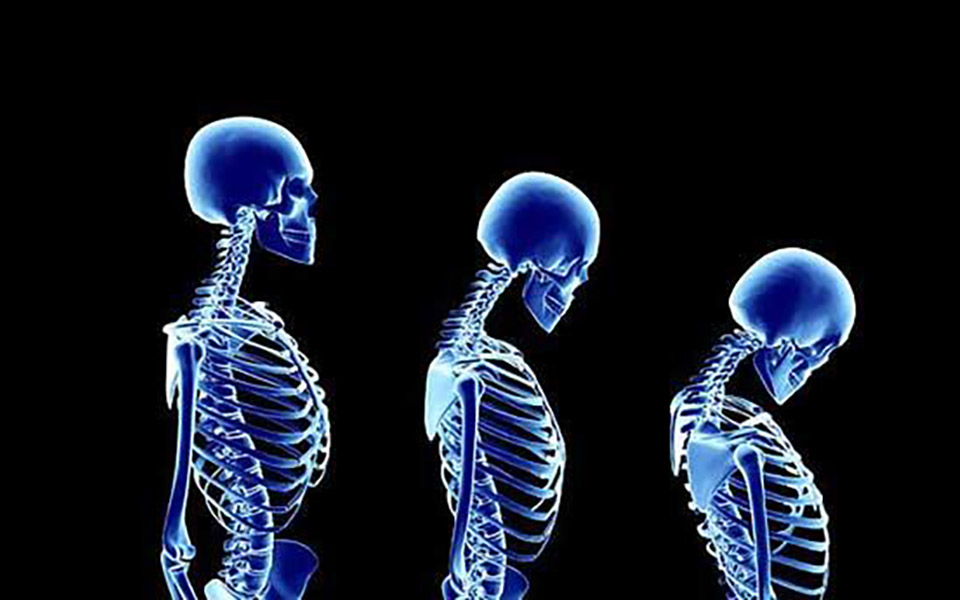 20-οκτωβρίου-παγκόσμια-ημέρα-οστεοπόρω-2343306