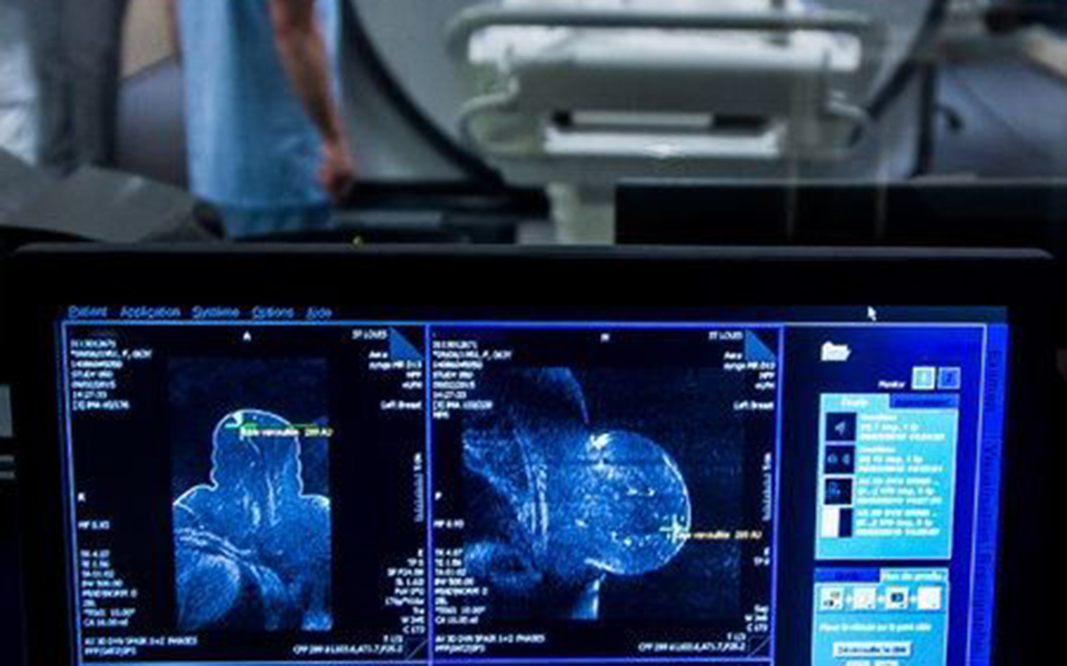 μαγνητική-για-πυκνούς-μαστούς-2350447