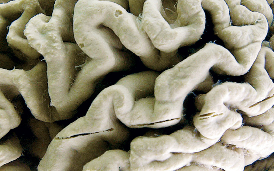 ενα-ημισφαίριο-αρκεί-για-να-λειτουργε-2349121