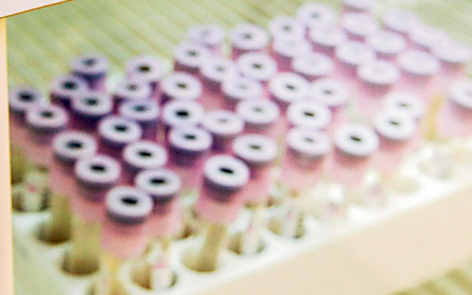 πρωτοποριακή-διαγνωστική-μέθοδος-γι-2350629