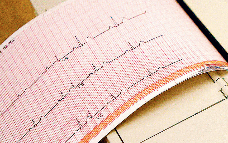 ελεγχος-χοληστερίνης-από-τα-25-2351354