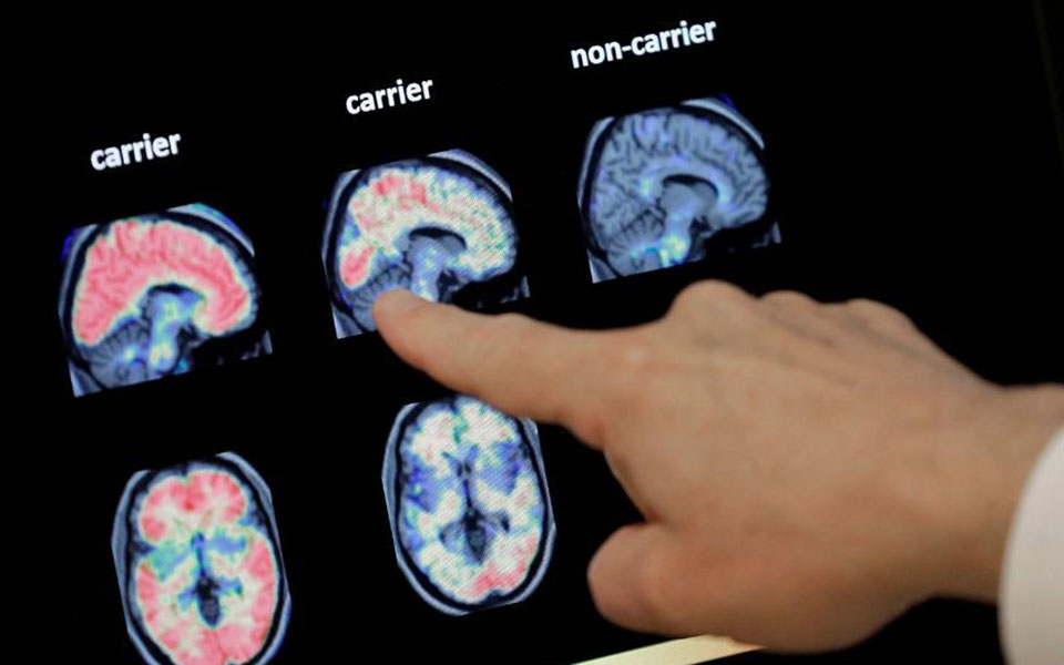 να-υποβληθεί-κανείς-σε-διαγνωστικό-τε-2355143