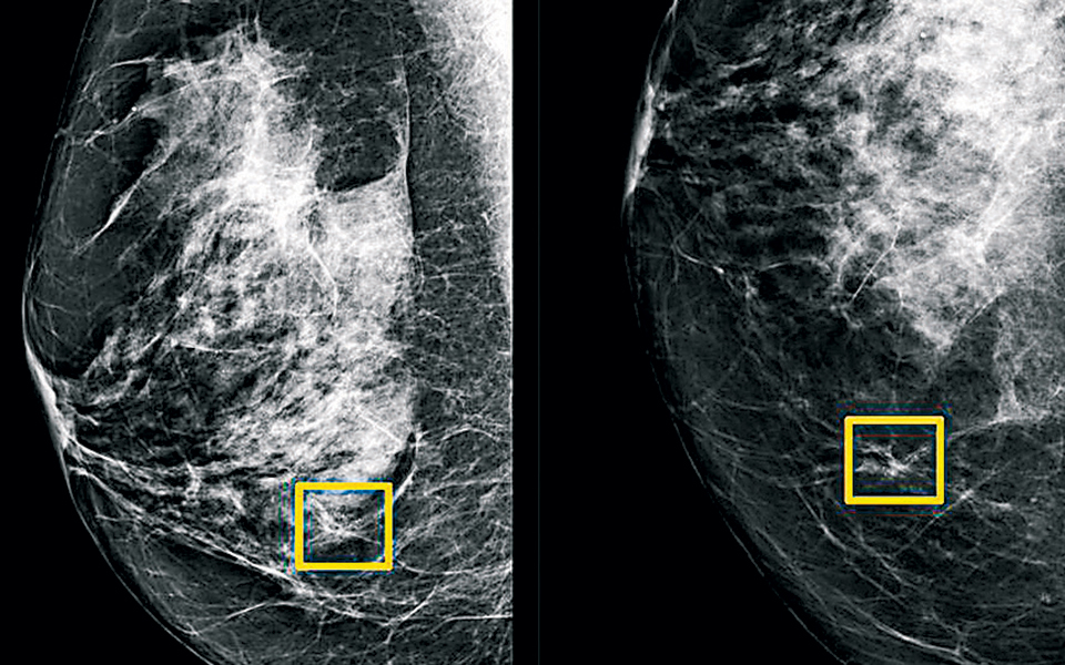 η-τεχνητή-νοημοσύνη-όπλο-στη-διάγνωση-2356125
