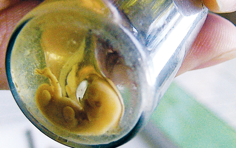 aνακούφιση-για-τη-διακοπή-της-κύησης-2357588