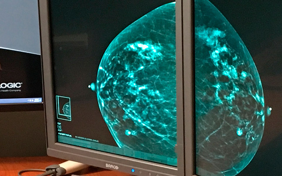 νέα-ανοσοθεραπεία-μειώνει-τον-κίνδυν-2365649