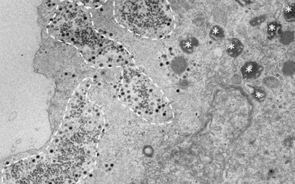 μυστηριώδης-νέος-ιός-ανακαλύφθηκε-στ-2362583