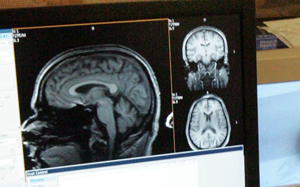 νέα-βήματα-από-ελληνες-επιστήμονες-γι-2367298