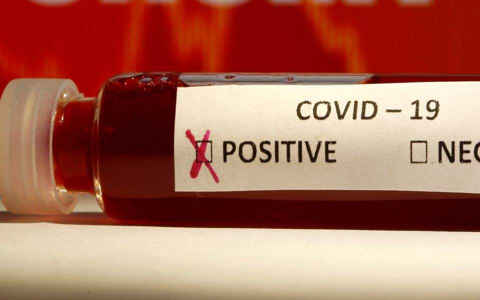 πιθανόν-ο-covid-19-να-γίνει-εποχικός-προειδοπ-2370339