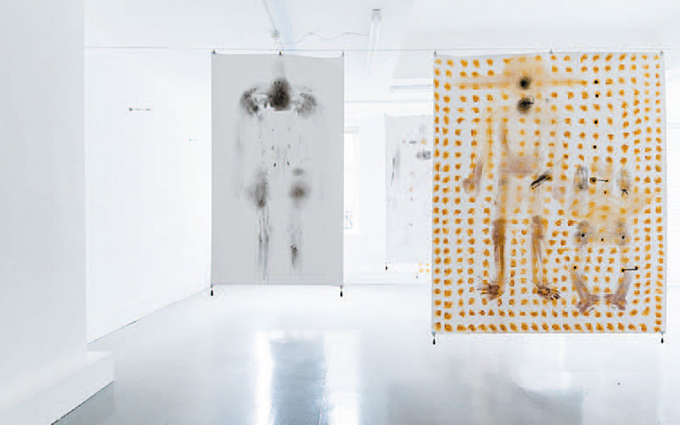 πλησιάζοντας-το-ασθενές-σώμα-2380259