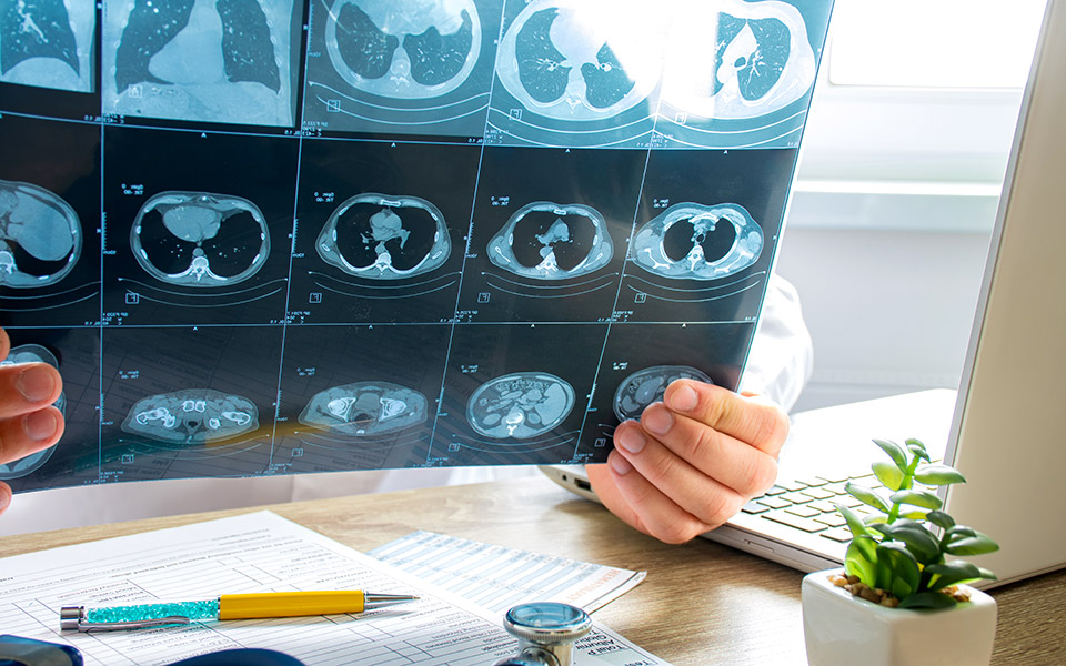 η-πνευμονική-αρτηριακή-υπέρταση-με-απ-2376752