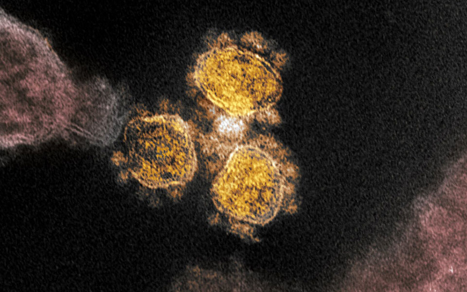 γιατί-κάποιοι-νοσούν-βαριά-από-covid-19-ενώ-ά-2391661