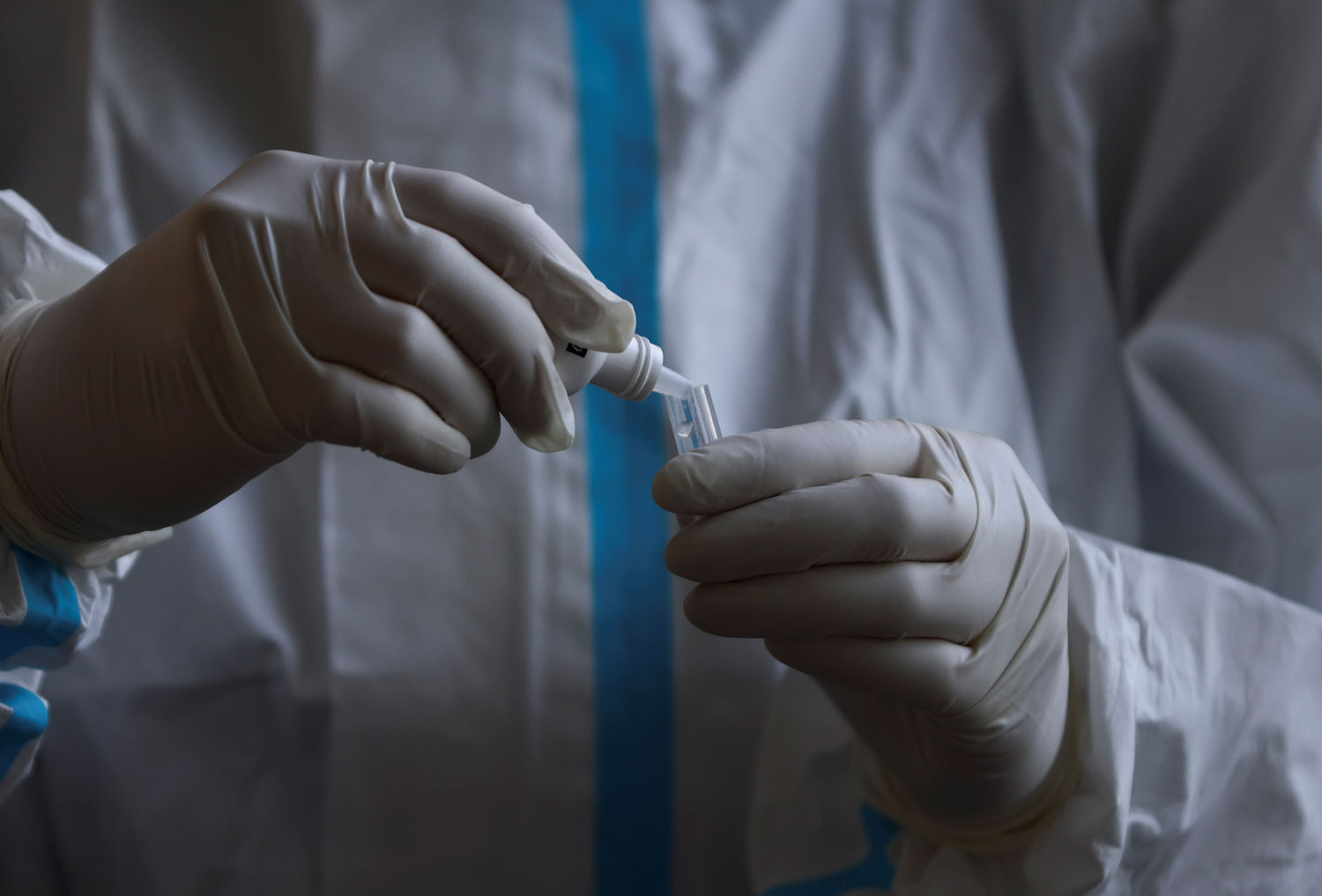 Επιστήμονες απομόνωσαν «πολύ αποτελεσματικά» αντισώματα κατά του Sars-CoV-2-1