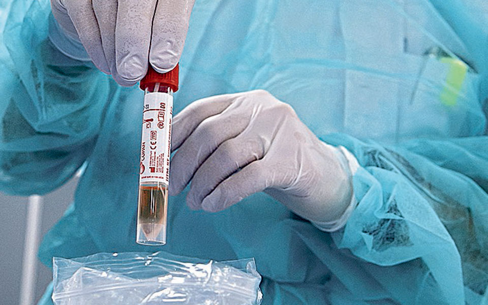 μελέτη-πώς-επηρεάζει-η-υγρασία-τη-διασ-561118990