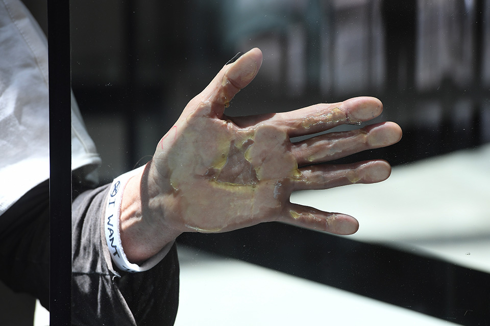 Κολλημένοι με το περιβάλλον