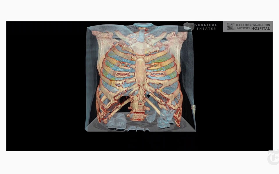 βίντεο-new-york-times-πώς-ο-κορωνοϊός-επιτίθεται-561253042