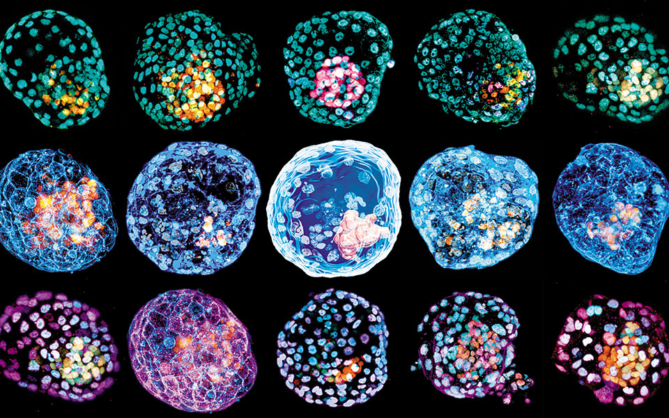 επανάσταση-στην-έρευνα-με-τα-βλαστοει-561298426