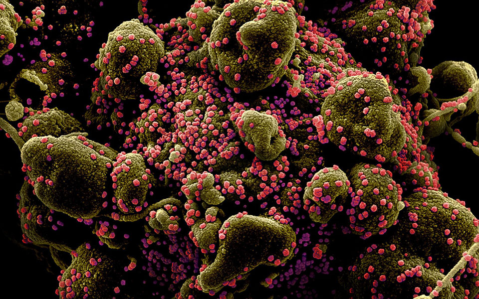 μελέτη-η-βραζιλιάνικη-παραλλαγή-δια-561281188