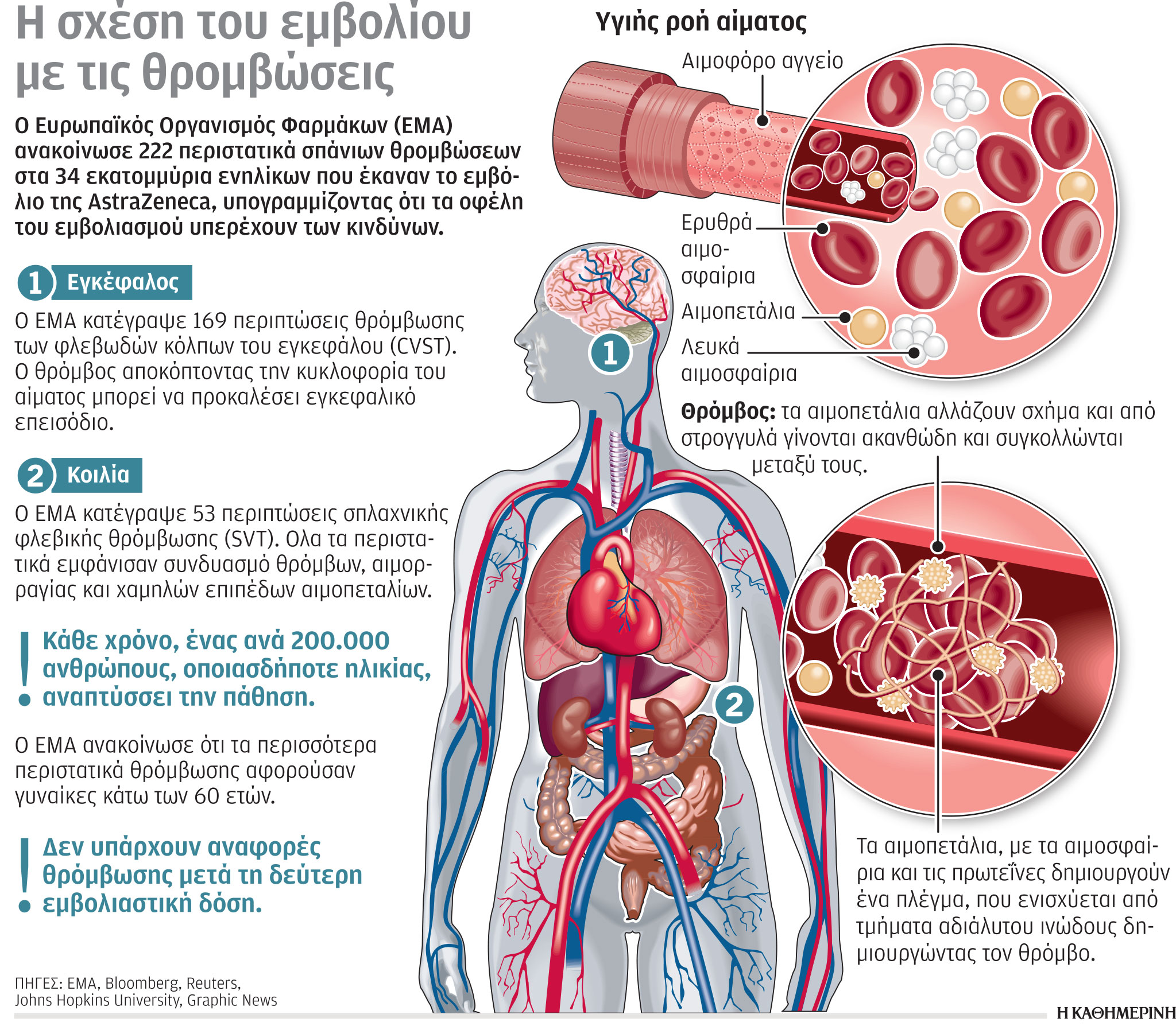 Εμβόλιο AstraZeneca: Ηλικιακό όριο ανά χώρα-1