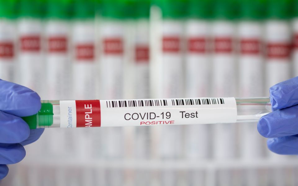 ισπανία-πωλούσε-πλαστά-αρνητικά-τεστ-co-561350977