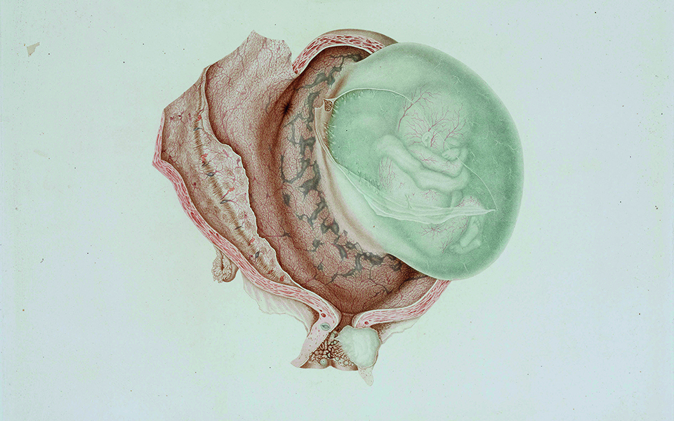 nεογνικός-έλεγχος-εναντίον-νωτιαίας-μ-561424114