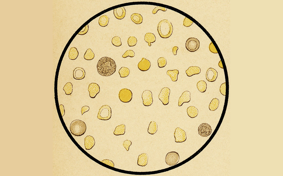 h-κατάλληλη-διαχείριση-μιας-δύσκολης-ν-561431833