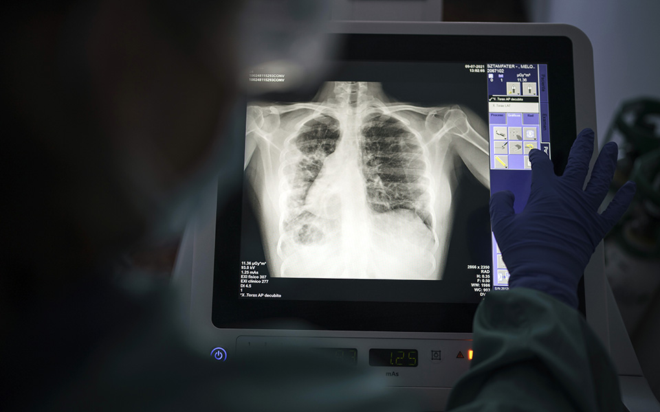 κορωνοϊός-3-273-κρούσματα-20-θάνατοι-286-διασω-561470062