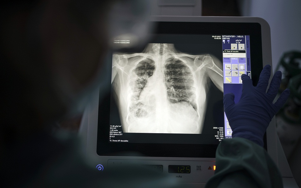 κορωνοϊός-τα-συμπτώματα-επιμένουν-το-561508315