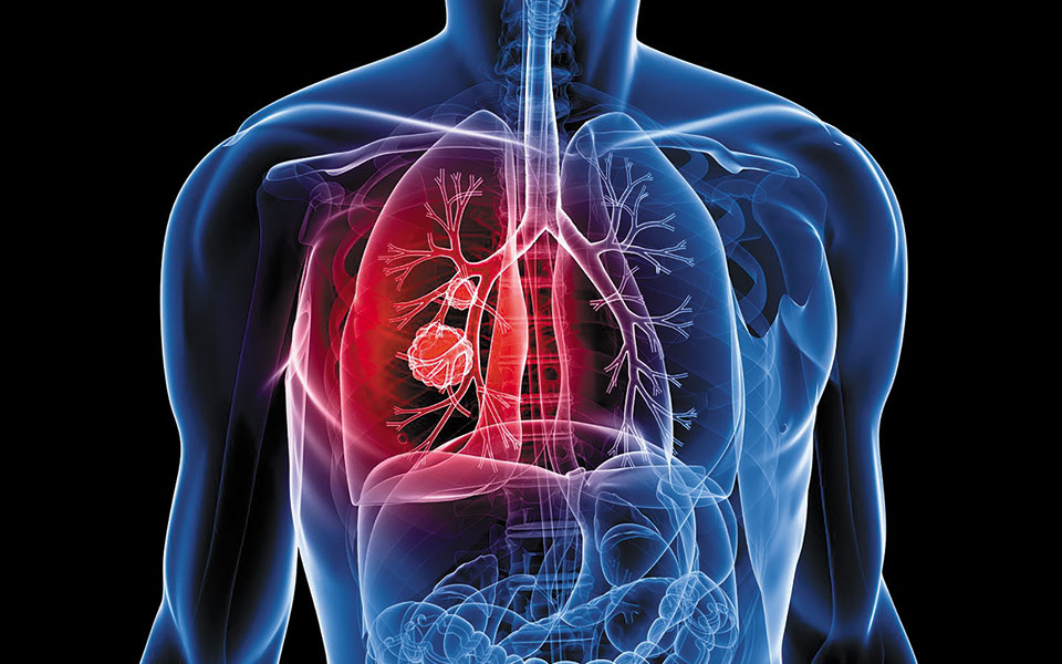 η-τεχνητή-νοημοσύνη-διαγιγνώσκει-καρ-561492304