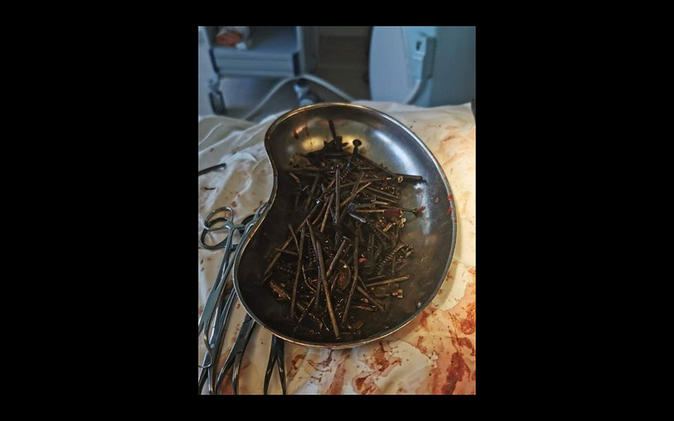 λιθουανία-βίδες-και-καρφιά-βρέθηκαν-σ-561521575