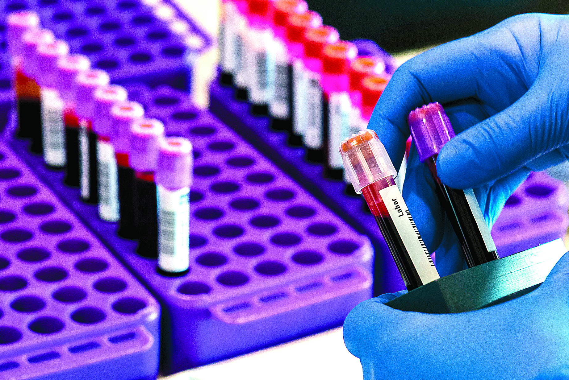 που-παγκόσμια-συμφωνία-για-δωρεάν-τεσ-561566764