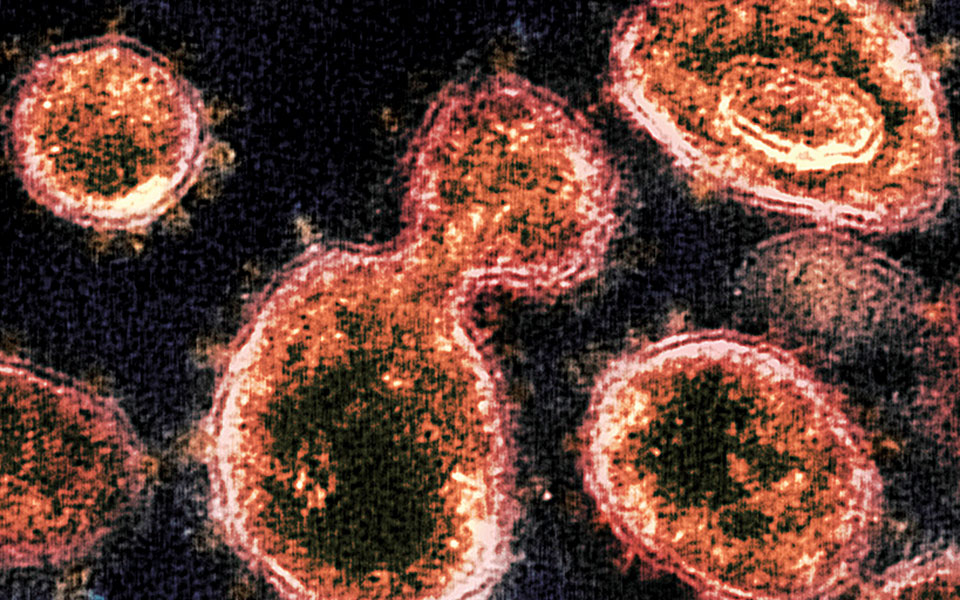 Μονοκλωνικά αντισώματα: Πέντε απαντήσεις-κλειδιά στην «Κ» για τη χορήγηση του νέου όπλου στη μάχη με τον ιό-1