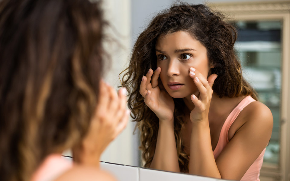 μαύροι-κύκλοι-πώς-να-απαλλαγείτε-ορισ-561638224