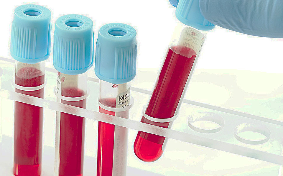 νέο-όπλο-στη-μάχη-κατά-του-καρκίνου-561658423