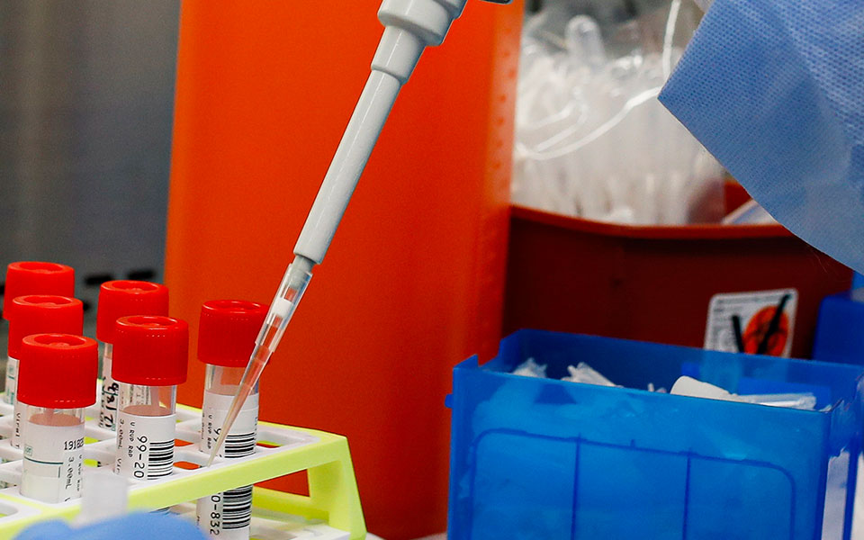 κορωνοϊός-υποψίες-για-τεστ-μαϊμού-σ-561690910