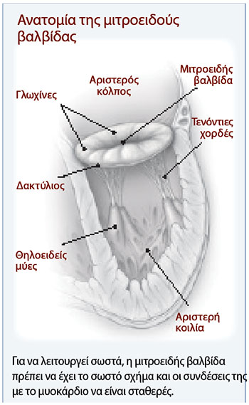 Τι προκαλεί την ανεπάρκεια της μιτροειδούς βαλβίδας; -1