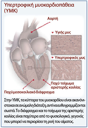 Ελπιδοφόρα νέα για μια κληρονομούμενη μορφή καρδιοπάθειας-1