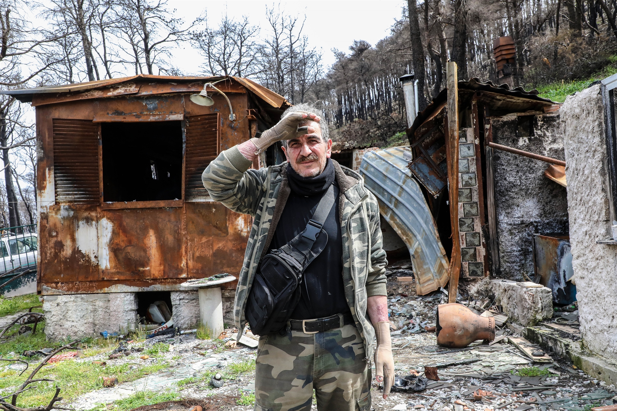 η-μακροχρόνια-μάχη-με-το-έγκαυμα-561815230