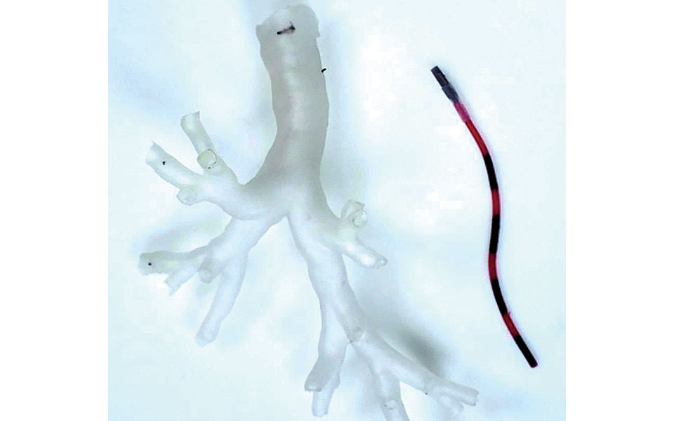 ένα-μικρό-ρομπότ-θα-εξερευνά-το-σώμα-μα-561800374